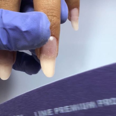 Limage de la démarcation