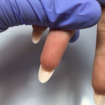 Utilisation de la gravité pour recentrer le gel