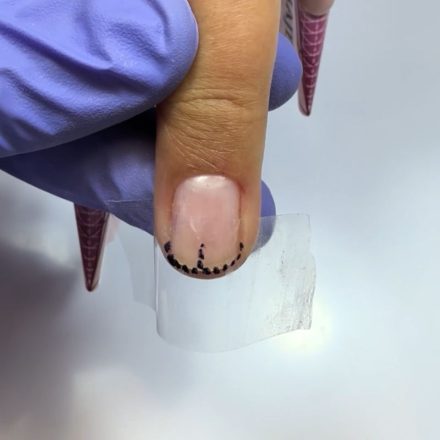 Prise de mesures de l’ongle