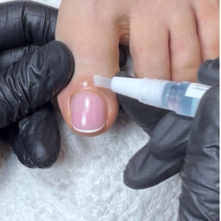 Hydratation des cuticules